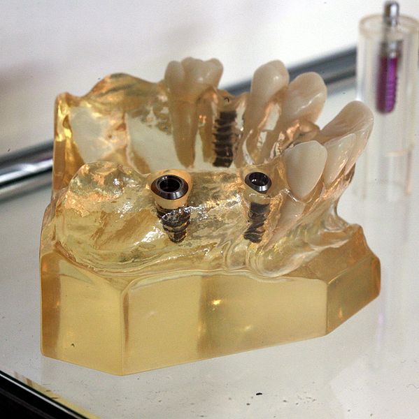 Dentures